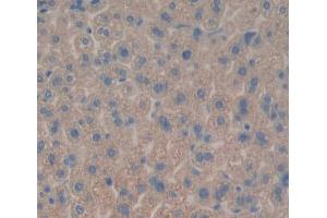 Used in DAB staining on fromalin fixed paraffin- embedded liver tissue (Tec Protein Tyrosine Kinase (TEC) (AA 369-622) 抗体)