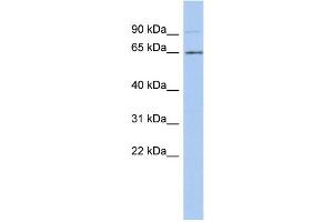 WB Suggested Anti-ZNF337 Antibody Titration:  0.