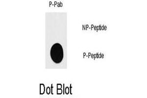 Dot blot analysis of RPS6KB1 (phospho S418) polyclonal antibody  on nitrocellulose membrane.