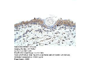 Rabbit Anti-RBMS1 Antibody  Paraffin Embedded Tissue: Human Skin Cellular Data: Squamous epithelial cells Antibody Concentration: 4. (RBMS1 抗体  (C-Term))