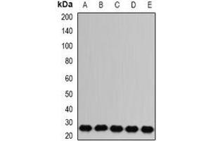 Western blot analysis of RAB17 expression in Jurkat (A), A431 (B), mouse brain (C), mouse kidney (D), rat liver (E) whole cell lysates. (RAB17 抗体)