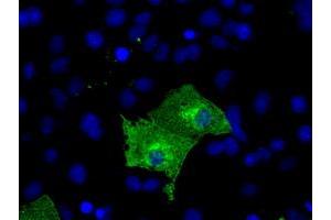 Anti-KIAA1609 mouse monoclonal antibody (ABIN2453206) immunofluorescent staining of COS7 cells transiently transfected by pCMV6-ENTRY KIAA1609 (RC209287). (KIAA1609 抗体)