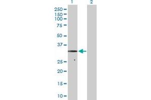 Western Blotting (WB) image for anti-Succinate Dehydrogenase Complex, Subunit B, Iron Sulfur (Ip) (SDHB) (AA 1-280) antibody (ABIN520105)