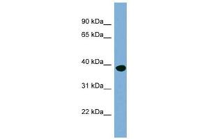 OAS1 antibody used at 1 ug/ml to detect target protein. (OAS1 抗体  (N-Term))