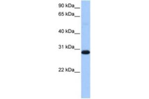 Western Blotting (WB) image for anti-Tryptophanyl tRNA Synthetase 2, Mitochondrial (WARS2) antibody (ABIN2463510) (WARS2 抗体)