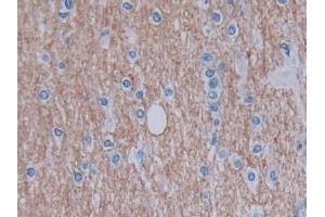 Detection of GHRH in Human Cerebrum Tissue using Monoclonal Antibody to Growth Hormone Releasing Hormone (GHRH) (GHRH 抗体  (AA 19-108))