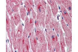 Immunohistochemistry (IHC) image for anti-Dystrophia Myotonica-Protein Kinase (DMPK) (Middle Region) antibody (ABIN2775281) (DMPK 抗体  (Middle Region))