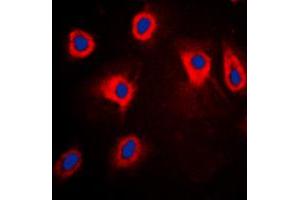 Immunofluorescent analysis of TPL2 (pT290) staining in HepG2 cells. (MAP3K8 抗体  (pSer290))