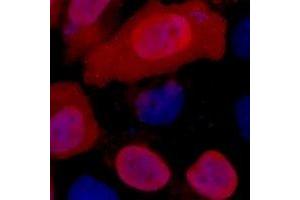 Immunofluorescent analysis of Myc-tag staining in 293T cells transfected with a Myc-tag protein. (Myc Tag 抗体)