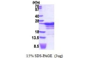 RNA Binding Motif Protein 18 (RBM18) (AA 1-190) protein (His tag)