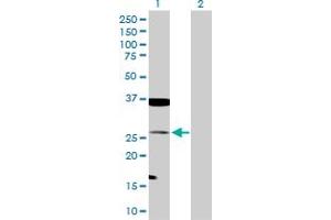 Western Blot analysis of TAGLN expression in transfected 293T cell line by TAGLN MaxPab polyclonal antibody. (Transgelin 抗体  (AA 1-201))