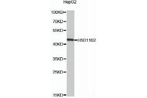 Western blot analysis of extracts of HepG2 cells using HSD11B2 Polyclonal Antibody at dilution of 1:1000. (HSD11B2 抗体)