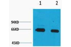 Western Blotting (WB) image for anti-Bovine Serum Albumin (BSA) antibody (ABIN3181294) (BSA 抗体)