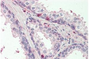 Human Prostate: Formalin-Fixed, Paraffin-Embedded (FFPE) (CCDC90A 抗体  (AA 252-301))