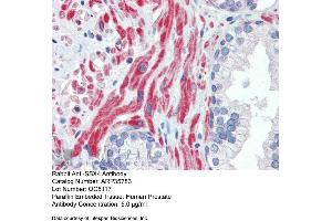 Immunohistochemistry with Human Prostate lysate tissue at an antibody concentration of 5. (SSX4 抗体  (Middle Region))
