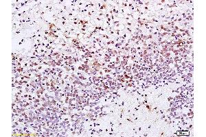 Immunohistochemistry (IHC) image for anti-X-Ray Repair Complementing Defective Repair in Chinese Hamster Cells 1 (XRCC1) (AA 1-120) antibody (ABIN673539)