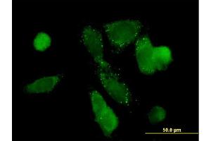 Immunofluorescence of monoclonal antibody to PCK1 on HepG2 cell. (PCK1 抗体  (AA 1-622))