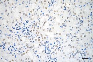 Immunohistochemistry was performed on paraffin-embedded mouse kidney using AKAP8 antibody (ABIN7797435), 1:200). (AKAP8 抗体)