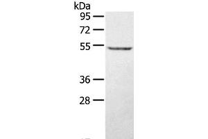 Western Blot analysis of A431 cell using STYK1 Polyclonal Antibody at dilution of 1:500 (STYK1 抗体)