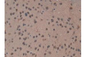 Detection of TOP2b in Mouse Brain Tissue using Polyclonal Antibody to Topoisomerase II Beta (TOP2b) (TOP2B 抗体  (AA 446-655))