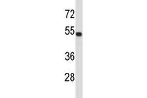TUBA4A antibody western blot analysis in MDA-MB435 lysate. (TUBA4A 抗体  (AA 417-446))