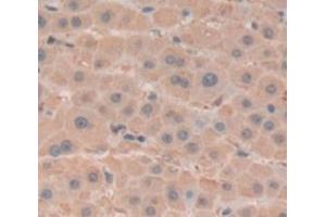IHC-P analysis of Human Tissue, with DAB staining. (BHMT 抗体  (AA 11-314))