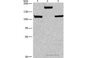 Western blot analysis of Mouse kidney tissue, 293T and 231 cell, using TP53BP2 Polyclonal Antibody at dilution of 1:375 (TP53BP2 抗体)