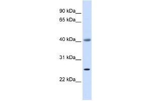 WB Suggested Anti-ADA Antibody Titration: 0. (ADA 抗体  (Middle Region))