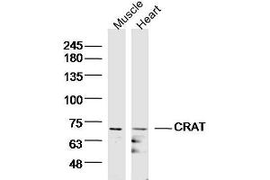 Lane 1: Mouse muscle lysates, Lane 2: mouse heart lysates probed with CRAT/CAT1 Polyclonal Antibody, Unconjugated  at 1:300 overnight at 4˚C. (CRAT 抗体  (AA 301-400))