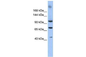 Western Blotting (WB) image for anti-Terminal Uridylyl Transferase 1, U6 SnRNA-Specific (TUT1) antibody (ABIN2458014) (TUT1 抗体)