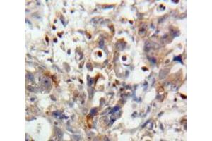 Used in DAB staining on fromalin fixed paraffin-embedded Pancreas tissue (IL28A 抗体  (AA 26-200))