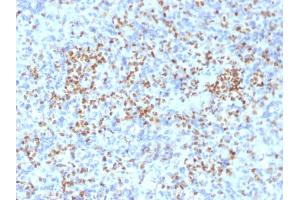 Immunohistochemistry (IHC) image for anti-Spleen Focus Forming Virus (SFFV) Proviral Integration Oncogene Spi1 (SPI1) (AA 16-170) antibody (ABIN6940631)