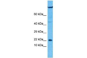 Host:  Rabbit  Target Name:  UXT  Sample Type:  U937 Whole Cell lysates  Antibody Dilution:  1. (UXT 抗体  (C-Term))