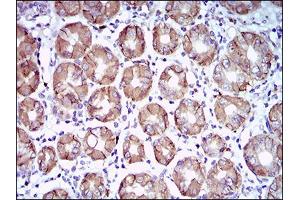 Immunohistochemistry (IHC) image for anti-Carbonic Anhydrase IX (CA9) (AA 37-186) antibody (ABIN1724883)