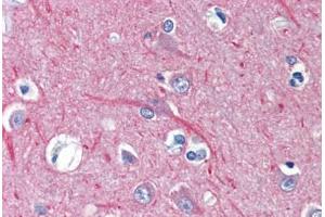 Human Brain, Cortex (formalin-fixed, paraffin-embedded) stained with TUBB antibody ABIN462130 followed by biotinylated anti-mouse IgG secondary antibody ABIN481714, alkaline phosphatase-streptavidin and chromogen. (TUBB 抗体)
