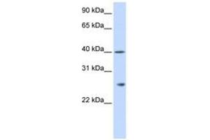 Image no. 1 for anti-Glutathione S-Transferase kappa 1 (GSTK1) (AA 36-85) antibody (ABIN6743827) (GSTK1 抗体  (AA 36-85))