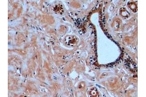 Detection of TUBb in Human Mammary gland Tissue using Monoclonal Antibody to Tubulin Beta (TUBb) (TUBB 抗体  (AA 170-419))