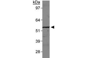 Western blot analysis of SLC2A9 in human kidney membrane with SLC2A9 polyclonal antibody . (SLC2A9 抗体  (AA 500-550))