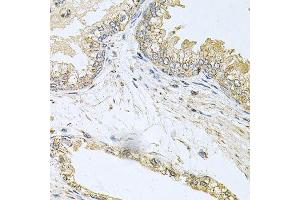 Immunohistochemistry of paraffin-embedded human prostate using BCR antibody. (BCR 抗体  (AA 1-300))