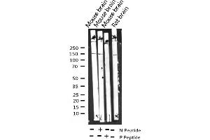 Western blot analysis of Phospho-GRF-1 (Tyr1105) expression in various lysates (GRLF1 抗体  (pTyr1105))