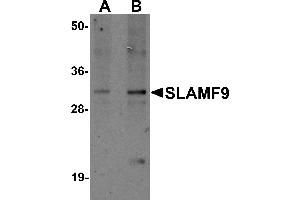 Western Blotting (WB) image for anti-SLAM Family Member 9 (SLAMF9) (C-Term) antibody (ABIN1030673) (SLAMF9 抗体  (C-Term))