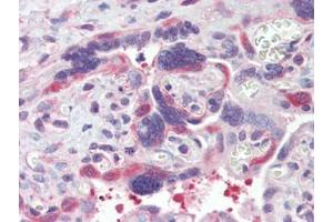 Immunohistochemistry (Paraffin-embedded Sections) (IHC (p)) image for anti-Heat Shock Protein 90kDa alpha (Cytosolic), Class B Member 1 (HSP90AB1) (AA 250-325) antibody (ABIN615278)