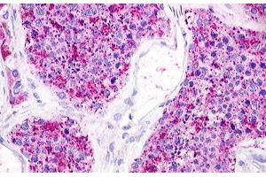 Image no. 1 for anti-Lysophosphatidic Acid Receptor 5 (LPAR5) (C-Term) antibody (ABIN1049019) (LPAR5 抗体  (C-Term))