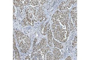IHC analysis of TRMT6 using anti-TRMT6 antibody (ABIN7602138). (TRMT6 抗体  (AA 6-489))