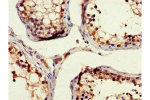 Immunohistochemistry of paraffin-embedded human testis tissue using ABIN7150275 at dilution of 1:100 (RAD54B 抗体  (AA 1-167))