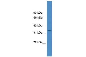 WB Suggested Anti-ELMOD1 Antibody Titration: 0. (ELMOD1 抗体  (Middle Region))