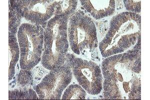 Image no. 2 for anti-Cyclin-Dependent Kinase Inhibitor 2B (p15, Inhibits CDK4) (CDKN2B) antibody (ABIN1497445) (CDKN2B 抗体)