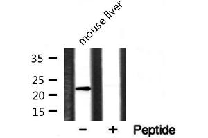 Western blot analysis of extracts of various cell lines, using CLDN1 antibody. (Claudin 1 抗体  (C-Term))