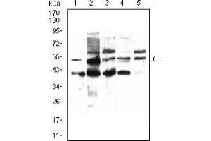 Western Blotting (WB) image for anti-Peroxisome Proliferator-Activated Receptor alpha (PPARA) (AA 1-120) antibody (ABIN5542540)