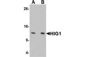 Western blot analysis of HIG1 in 293 cell lysate with HIG1 Antibody  at at (A) 0. (HIGD1A 抗体  (N-Term))